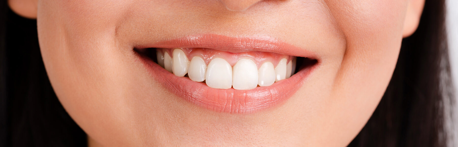 What Causes White Discoloration on Teeth? Early Signs of Enamel Issues