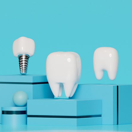 Why Dental Implants Boost Confidence and Quality of Life